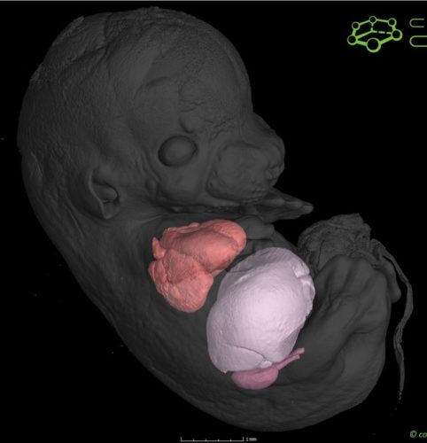 myší embryo segmentované srdce játra a ledviny