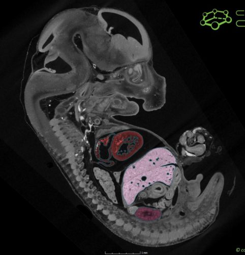 myší embryo segmentované srdce játra a ledviny – řez
