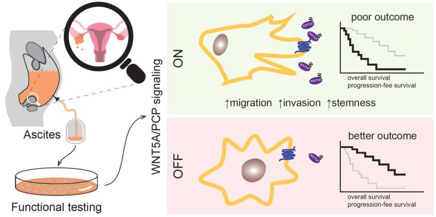 WNT signaling inducing activity in ascites predicts poor outcome in ovarian cancer