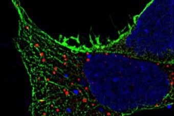 Invitation: How Do We See Our Sample? – Considerations for High Resolution and Super Resolution Microscopy