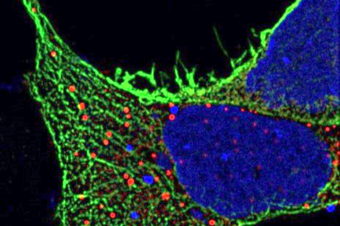 Pozvánka: How Do We See Our Sample? – Considerations for High Resolution and Super Resolution Microscopy