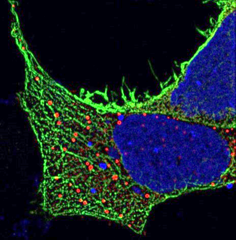 Pozvánka: How Do We See Our Sample? – Considerations for High Resolution and Super Resolution Microscopy