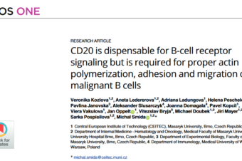 CD20 is dispensable for B-cell receptor signaling but is required for proper actin polymerization, adhesion and migration of malignant B cells