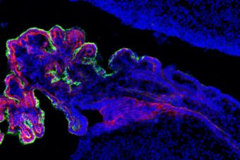 New pre-print: MEIS-WNT5A axis regulates development of 4th ventricle choroid plexus