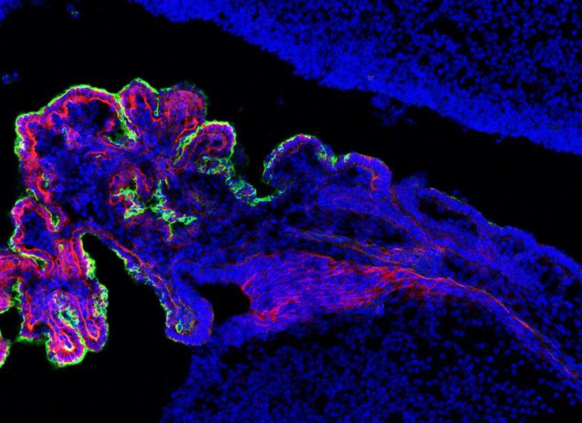 New pre-print: MEIS-WNT5A axis regulates development of 4th ventricle choroid plexus