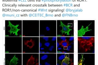 New preprint: Lyn controls chemotaxis and motility of CLL cells via phosphorylation of ROR1