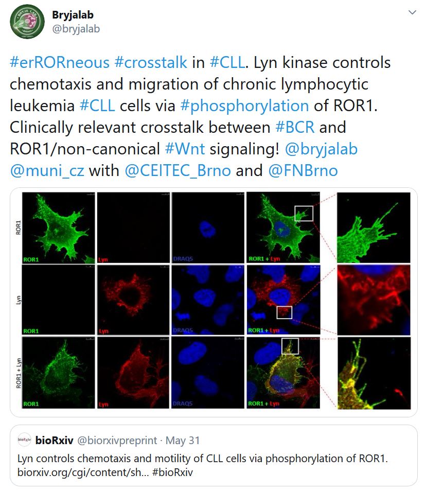 New preprint: Lyn controls chemotaxis and motility of CLL cells via phosphorylation of ROR1