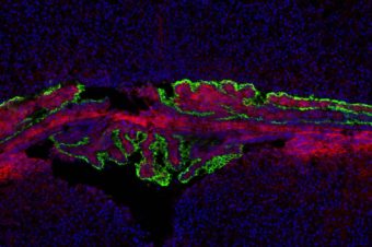 Wnttalks: Talk by Bryjalab on Wnt5a and choroid plexus! – 6. 5. 2021