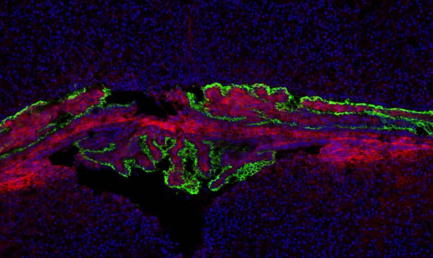 Wnttalks: Talk by Bryjalab on Wnt5a and choroid plexus! – 6. 5. 2021