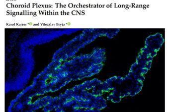 Choroid Plexus: The Orchestrator of Long-Range Signalling Within the CNS