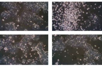 The biocompatibility of polyaniline and polypyrrole 2: Doping with organic phosphonates