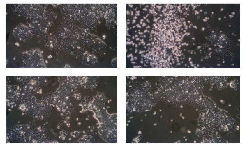 The biocompatibility of polyaniline and polypyrrole 2: Doping with organic phosphonates