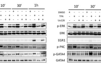 12-O-Tetradecanoylphorbol-13-acetate increases cardiomyogenesis through PKC/ERK signaling