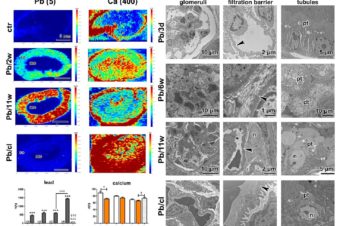 A Clearance Period after Soluble Lead Nanoparticle Inhalation Did Not Ameliorate the Negative Effects on Target Tissues Due to Decreased Immune Response