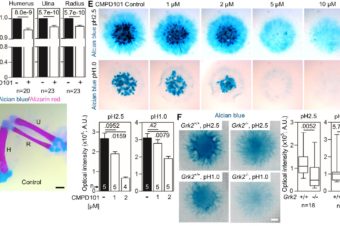 Mutations in GRK2 cause Jeune syndrome by impairing Hedgehog and canonical Wnt signaling