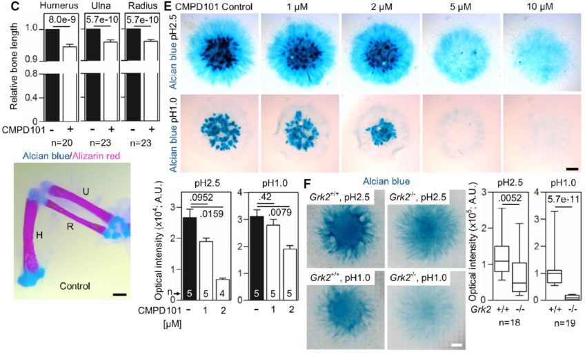 Mutations in GRK2 cause Jeune syndrome by impairing Hedgehog and canonical Wnt signaling