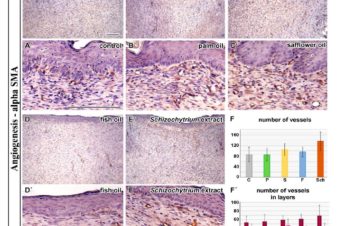 Comparison of Dietary Oils with Different Polyunsaturated Fatty Acid n-3 and n-6 Content in the Rat Model of Cutaneous Wound Healing