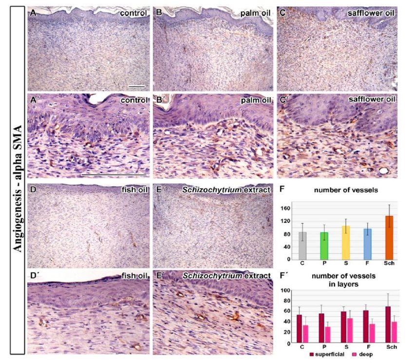 Comparison of Dietary Oils with Different Polyunsaturated Fatty Acid n-3 and n-6 Content in the Rat Model of Cutaneous Wound Healing