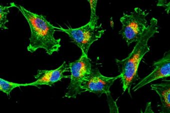 Molecular and Cell Biology – nový NMgr. program v angličtině