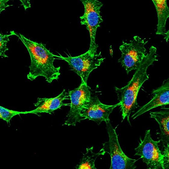 New Study program in English! – Molecular and Cell Biology