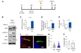 Primary Cilia Formation Does Not Rely on WNT/β-Catenin Signaling