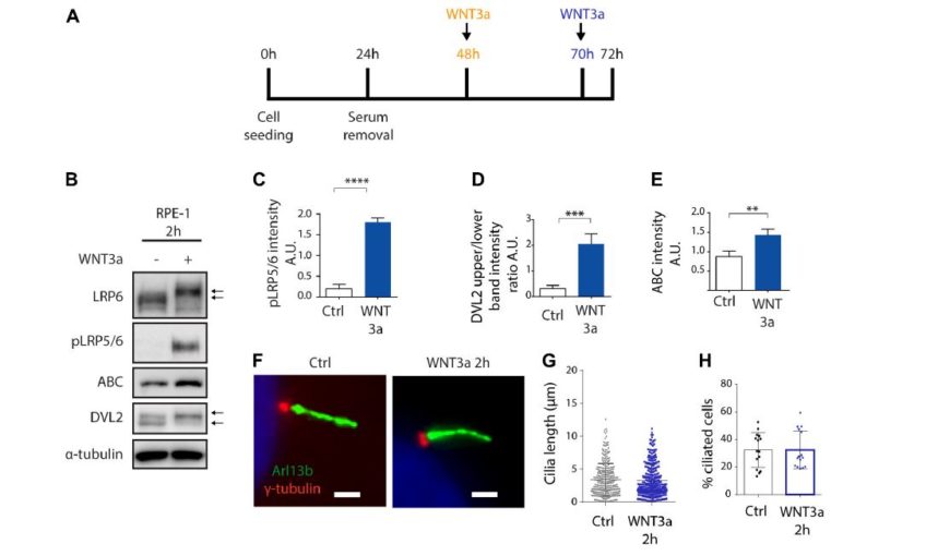 Primary Cilia Formation Does Not Rely on WNT/β-Catenin Signaling