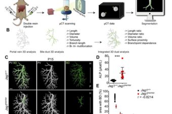 DUCT reveals architectural mechanisms contributing to bile duct recovery in a mouse model for Alagille syndrome