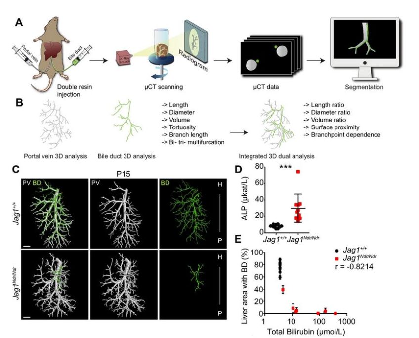 DUCT reveals architectural mechanisms contributing to bile duct recovery in a mouse model for Alagille syndrome