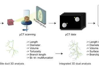 DUCT reveals architectural mechanisms contributing to bile duct recovery in a mouse model for Alagille syndrome