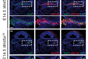 Our work recently accepted in Development & highlighted in Development presents