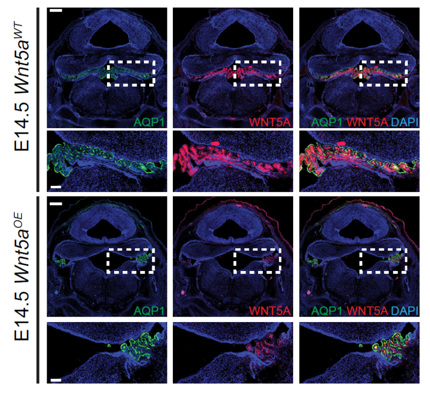 Our work recently accepted in Development & highlighted in Development presents