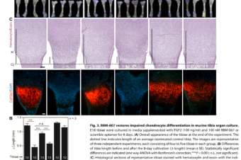 An RNA aptamer restores defective bone growth in FGFR3-related skeletal dysplasia in mice