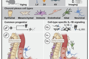 A cellular and spatial map of the choroid plexus across brain ventricles and ages