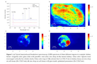 Methodology for the Implementation of Internal Standard to Laser-Induced Breakdown Spectroscopy Analysis of Soft Tissues