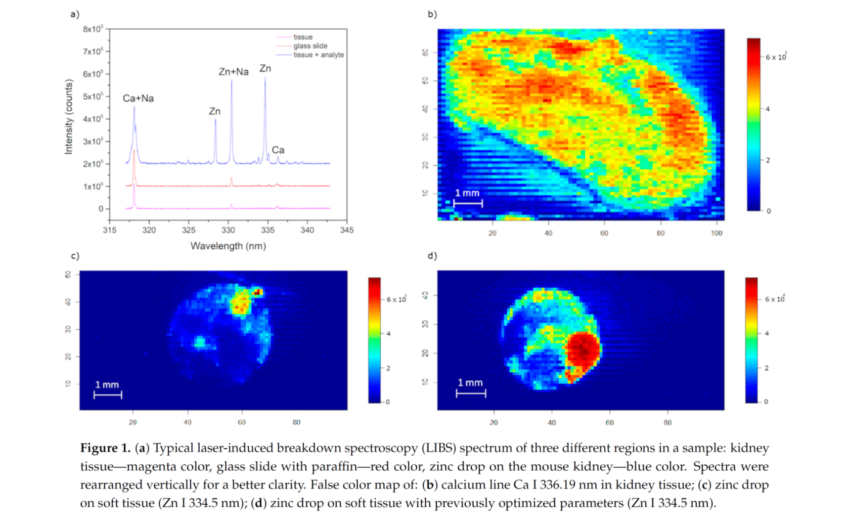 Methodology for the Implementation of Internal Standard to Laser-Induced Breakdown Spectroscopy Analysis of Soft Tissues