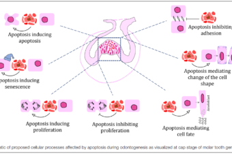 Role of Cell Death in Cellular Processes During Odontogenesis