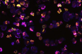 Migrace buněk pod mikroskopem