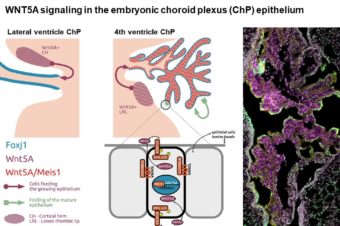 MEIS-WNT5A axis regulates development of fourth ventricle choroid plexus