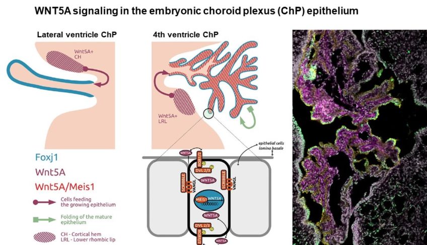 MEIS-WNT5A axis regulates development of fourth ventricle choroid plexus