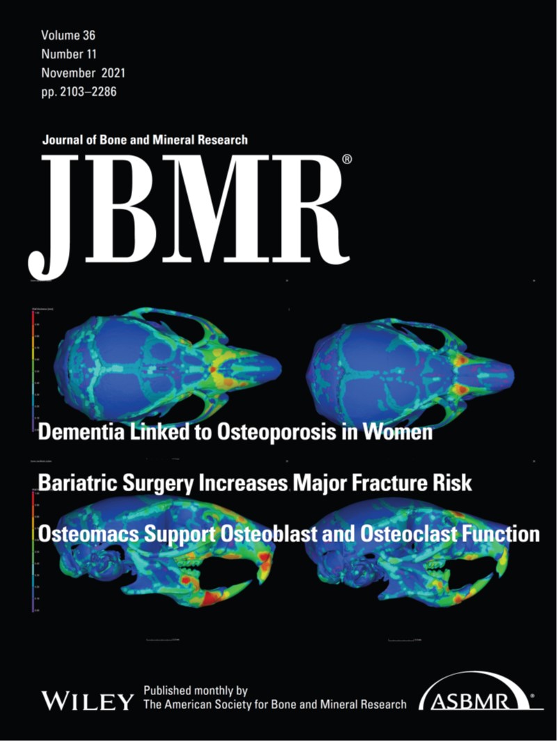 Publication from M. Buchtova lab as a cover of new issue of Journal of Bone and Mineral Research!