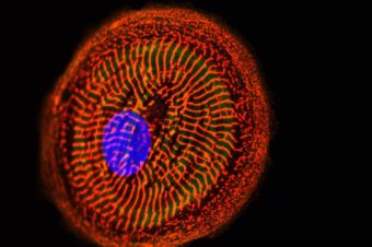 Přednáška: Patient-Specific Derived Cardiomyocytes – Will We Be Able to Predict the Cardiomyopathies in the Dish Tomorrow?, 20. 1. 2022 v 10.00