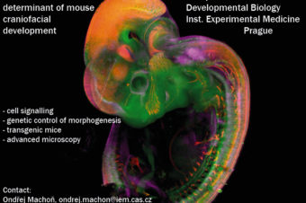 Nabídka PhD pozice – The neural network as a determinant of mouse craniofacial development