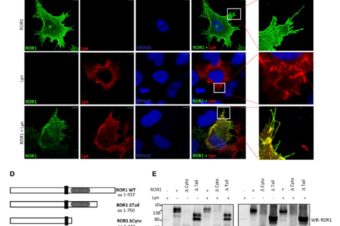 Lyn Phosphorylates and Controls ROR1 Surface Dynamics During Chemotaxis of CLL Cells