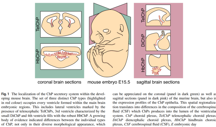 Regulation of choroid plexus development and its functions