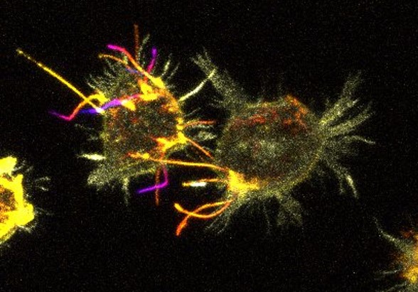 Pozvánka: Cytonemes in cell signalling – Spreading Wnt signals in development and disease, 23. 3. 2023