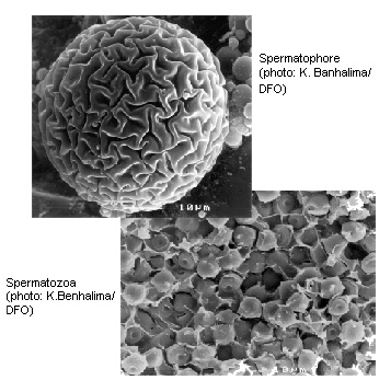 Spermatophore and spermatozoa (photo: K.Benhalima/DFO)